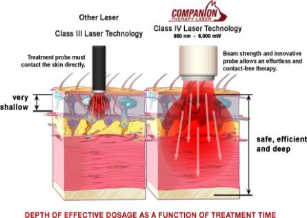 companion laser therapy
